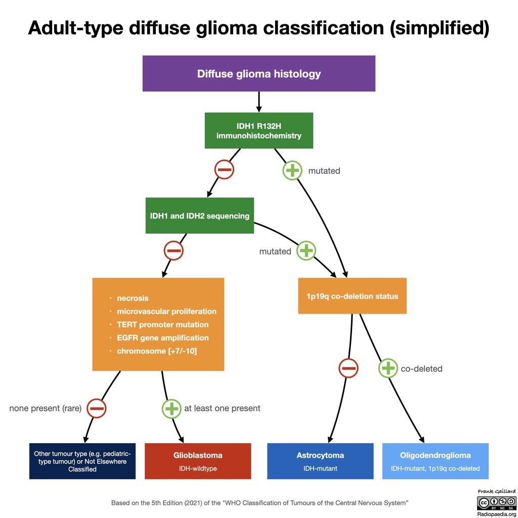 Glioma classifications showing the flow to diagnosis